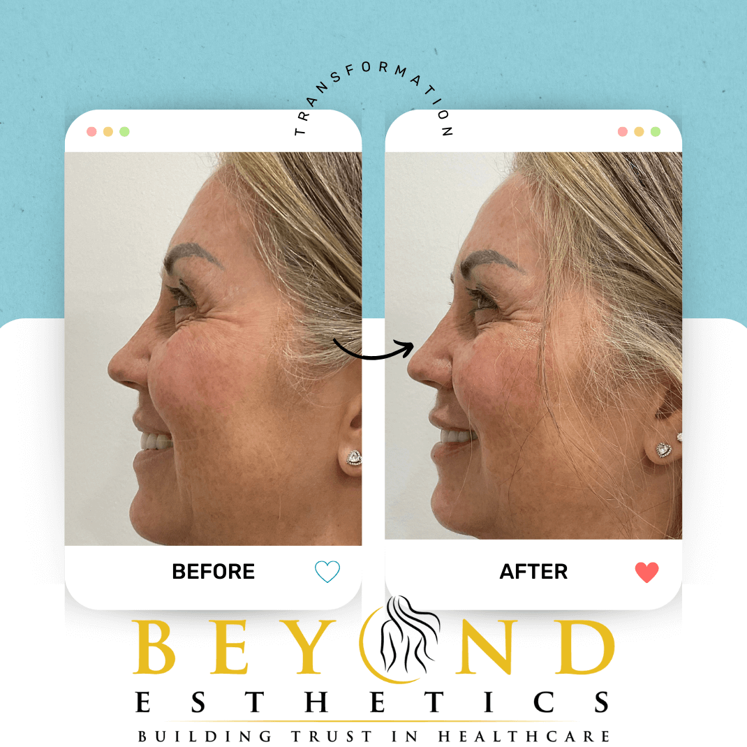 Profile, facial balancing